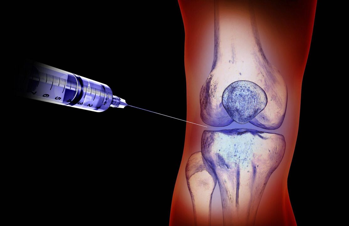 Intra-articular injection for arthrosis