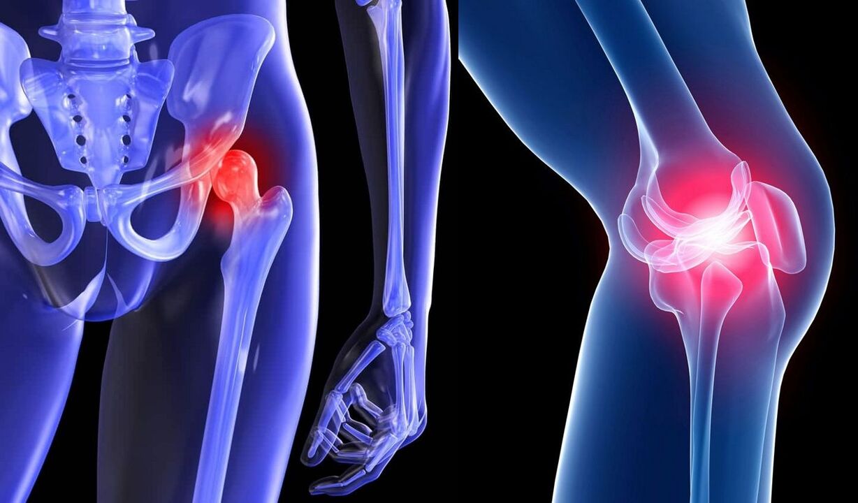 Joint pain symptoms