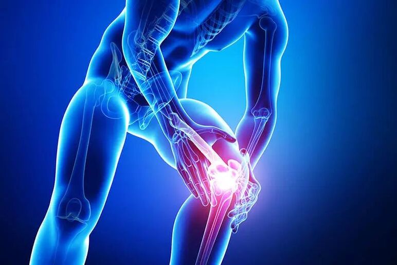 Symptoms of arthrosis